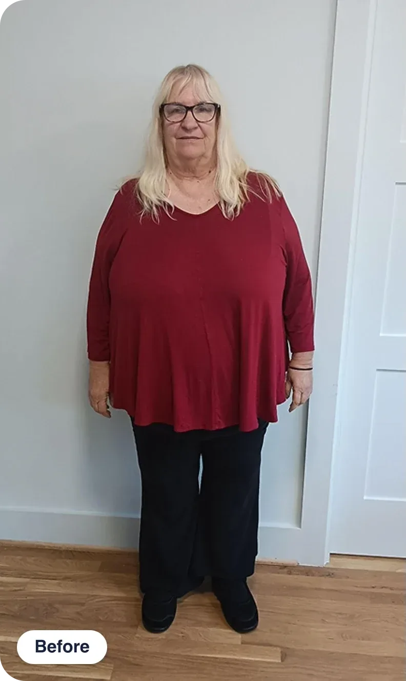 Linda M. before